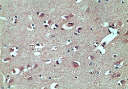 TARBP2 / TRBP2 Antibody - IHC of normal human brain using antibody (TRBP) at 5 ug/ml.