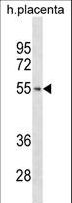 TARBP2 / TRBP2 Antibody - TARBP2 Antibody western blot of human placenta tissue lysates (35 ug/lane). The TARBP2 antibody detected the TARBP2 protein (arrow).