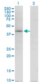 TARBP2 / TRBP2 Antibody - Western blot of TARBP2 expression in transfected 293T cell line by TARBP2 monoclonal antibody (M08), clone 1G6.