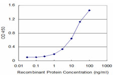 TARBP2 / TRBP2 Antibody - Detection limit for recombinant GST tagged TARBP2 is approximately 0.3 ng/ml as a capture antibody.