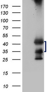 TARBP2 / TRBP2 Antibody - HEK293T cells were transfected with the pCMV6-ENTRY control. (Left lane) or pCMV6-ENTRY TARBP2. (Right lane) cDNA for 48 hrs and lysed. Equivalent amounts of cell lysates. (5 ug per lane) were separated by SDS-PAGE and immunoblotted with anti-TARBP2. (1:2000)