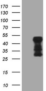 TARBP2 / TRBP2 Antibody - HEK293T cells were transfected with the pCMV6-ENTRY control (Left lane) or pCMV6-ENTRY TARBP2 (Right lane) cDNA for 48 hrs and lysed. Equivalent amounts of cell lysates (5 ug per lane) were separated by SDS-PAGE and immunoblotted with anti-TARBP2 (1:2000).