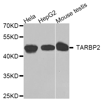 TARBP2 / TRBP2 Antibody - Western blot analysis of extracts of various cell lines.