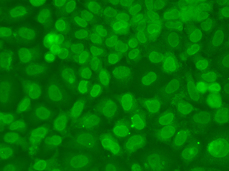 TARBP2 / TRBP2 Antibody - Immunofluorescence analysis of A549 cells.