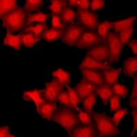 TARBP2 / TRBP2 Antibody