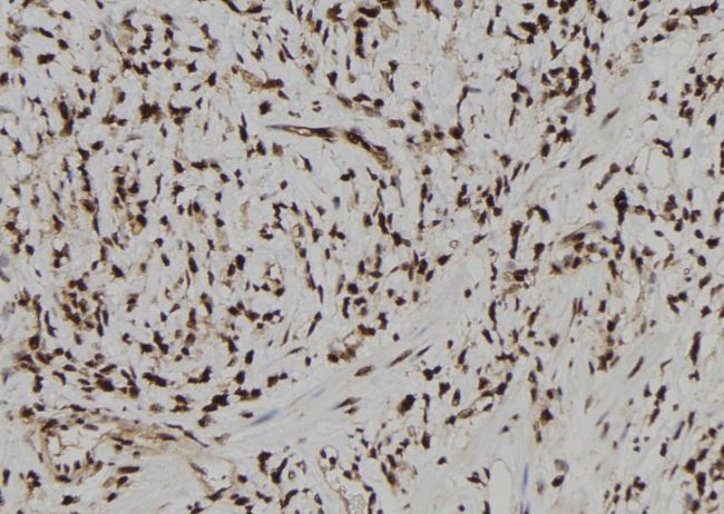 TARBP2 / TRBP2 Antibody - 1:100 staining human gastric tissue by IHC-P. The sample was formaldehyde fixed and a heat mediated antigen retrieval step in citrate buffer was performed. The sample was then blocked and incubated with the antibody for 1.5 hours at 22°C. An HRP conjugated goat anti-rabbit antibody was used as the secondary.