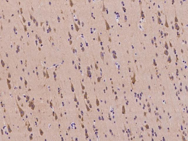 TARBP2 / TRBP2 Antibody - Immunochemical staining of human TARBP2 in human brain with rabbit polyclonal antibody at 1:500 dilution, formalin-fixed paraffin embedded sections.
