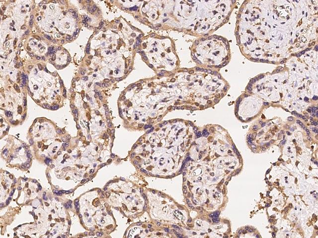 TARBP2 / TRBP2 Antibody - Immunochemical staining of human TARBP2 in human placenta with rabbit polyclonal antibody at 1:500 dilution, formalin-fixed paraffin embedded sections.