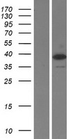 TARBP2 / TRBP2 Protein - Western validation with an anti-DDK antibody * L: Control HEK293 lysate R: Over-expression lysate