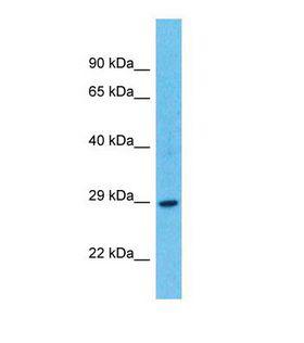 TARM1 Antibody - Western blot of Human MCF7. TARM1 antibody dilution 1.0 ug/ml.  This image was taken for the unconjugated form of this product. Other forms have not been tested.
