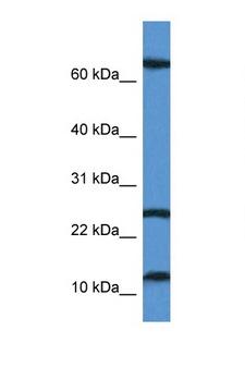 TARP / CD3G Antibody - TARP antibody Western blot of Jurkat Cell lysate. Antibody concentration 1 ug/ml.  This image was taken for the unconjugated form of this product. Other forms have not been tested.