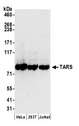 TARS Antibody - Detection of human TARS by western blot. Samples: Whole cell lysate (50 µg) from HeLa, HEK293T, and Jurkat cells prepared using NETN lysis buffer. Antibodies: Affinity purified rabbit anti-TARS antibody used for WB at 0.1 µg/ml. Detection: Chemiluminescence with an exposure time of 10 seconds.