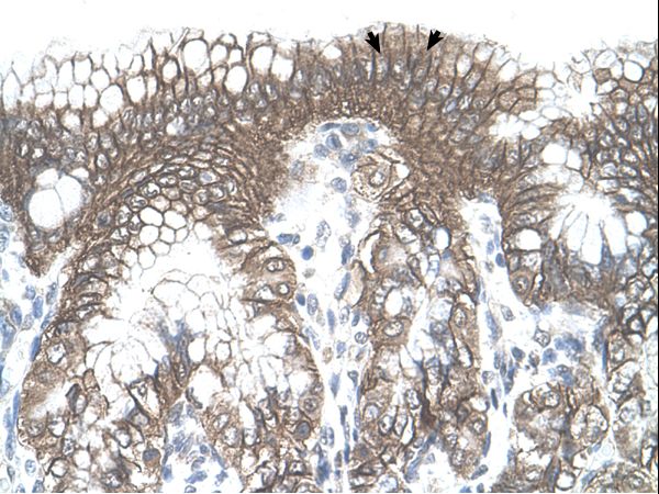 TARS Antibody - TARS antibody TARS(threonyl-tRNA synthetase) Antibody was used in IHC to stain formalin-fixed, paraffin-embedded human stomach.  This image was taken for the unconjugated form of this product. Other forms have not been tested.