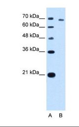 TARS Antibody - Lane A: Marker. Lane B: HepG2 cell lysate. Antibody concentration: 5.0 ug/ml. Gel concentration: 12%.  This image was taken for the unconjugated form of this product. Other forms have not been tested.