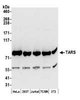 TARS Antibody - Detection of human and mouse TARS by western blot. Samples: Whole cell lysate (50 µg) from HeLa, HEK293T, Jurkat, mouse TCMK-1, and mouse NIH 3T3 cells prepared using NETN lysis buffer. Antibodies: Affinity purified rabbit anti-TARS antibody used for WB at 0.1 µg/ml. Detection: Chemiluminescence with an exposure time of 10 seconds.