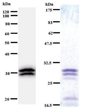 TARS Antibody - Western blot of immunized recombinant protein using TARS antibody. Left: TARS staining. Right: Coomassie Blue staining of immunized recombinant protein.