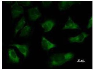 TARS Antibody - Immunofluorescent staining using TARS antibody. Immunostaining analysis in HeLa cells. HeLa cells were fixed with 4% paraformaldehyde and permeabilized with 0.01% Triton-X100 in PBS. The cells were immunostained with anti-TARS antibody.