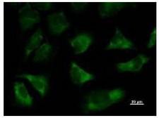 TARS Antibody - Immunofluorescent staining using TARS antibody. Immunostaining analysis in HeLa cells. HeLa cells were fixed with 4% paraformaldehyde and permeabilized with 0.01% Triton-X100 in PBS. The cells were immunostained with anti-TARS antibody.