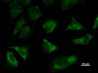 TARS Antibody - Immunostaining analysis in HeLa cells. HeLa cells were fixed with 4% paraformaldehyde and permeabilized with 0.1% Triton X-100 in PBS. The cells were immunostained with anti-TARS mAb.