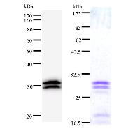 TARS Antibody - Left : Western blot analysis of immunized recombinant protein, using anti-TARS monoclonal antibody. Right : CBB staining of immunized recombinant protein.