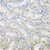 TARS Antibody - Immunohistochemistry of paraffin-embedded mouse kidney tissue.