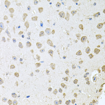 TARS Antibody - Immunohistochemistry of paraffin-embedded mouse brain tissue.
