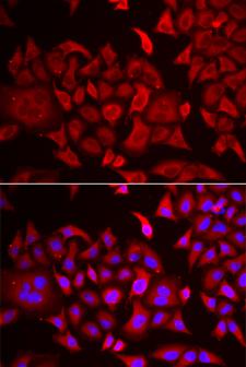 TARS Antibody - Immunofluorescence analysis of HeLa cells.