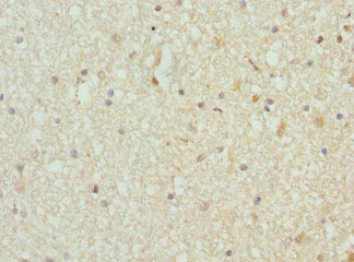 TARS Antibody - Immunohistochemistry of paraffin-embedded human brain tissue at dilution 1:100