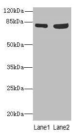 TARS Antibody - Western blot All Lanes: TARSantibody at 4.85ug/ml Lane 1 : A549 whole cell lysate Lane 2 : Hela whole cell lysate Secondary Goat polyclonal to Rabbit IgG at 1/10000 dilution Predicted band size: 84,87 kDa Observed band size: 83 kDa