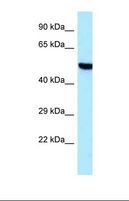 TARS2 / TARSL1 Antibody - Western blot of Human HepG2. TARS2 antibody dilution 1.0 ug/ml.  This image was taken for the unconjugated form of this product. Other forms have not been tested.