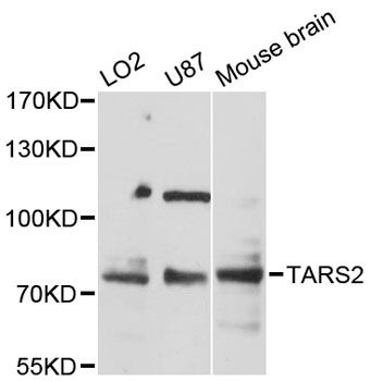 TARS2 / TARSL1 Antibody - Western blot analysis of extracts of various cell lines, using TARS2 antibody at 1:3000 dilution. The secondary antibody used was an HRP Goat Anti-Rabbit IgG (H+L) at 1:10000 dilution. Lysates were loaded 25ug per lane and 3% nonfat dry milk in TBST was used for blocking. An ECL Kit was used for detection and the exposure time was 30s.