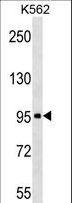 TARSH / ABI3BP Antibody - ABI3BP Antibody western blot of K562 cell line lysates (35 ug/lane). The ABI3BP antibody detected the ABI3BP protein (arrow).