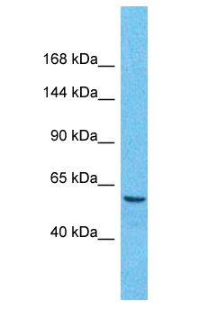 TARSH / ABI3BP Antibody - TARSH / ABI3BP antibody Western Blot of Thymus Tumor. Antibody dilution: 1 ug/ml.  This image was taken for the unconjugated form of this product. Other forms have not been tested.