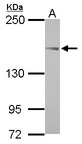 TARSH / ABI3BP Antibody - Sample (30 ug of whole cell lysate) A: HeLa 5% SDS PAGE ABI3BP antibody diluted at 1:1000