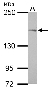 TARSH / ABI3BP Antibody - Sample (30 ug of whole cell lysate) A: HeLa 5% SDS PAGE ABI3BP antibody diluted at 1:1000