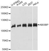 TARSH / ABI3BP Antibody - Western blot analysis of extracts of various cell lines, using ABI3BP antibody at 1:1000 dilution. The secondary antibody used was an HRP Goat Anti-Rabbit IgG (H+L) at 1:10000 dilution. Lysates were loaded 25ug per lane and 3% nonfat dry milk in TBST was used for blocking. An ECL Kit was used for detection and the exposure time was 20s.