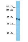 TARSL2 Antibody - TARSL2 antibody Western Blot of HepG2. Antibody dilution: 1 ug/ml.  This image was taken for the unconjugated form of this product. Other forms have not been tested.