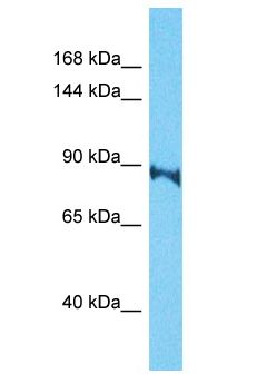 TARSL2 Antibody - TARSL2 antibody Western Blot of HepG2. Antibody dilution: 1 ug/ml.  This image was taken for the unconjugated form of this product. Other forms have not been tested.