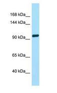 TAS1R2 / T1R2 Antibody - TAS1R2 / T1R2 antibody Western Blot of Fetal Brain.  This image was taken for the unconjugated form of this product. Other forms have not been tested.