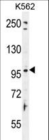 TAS1R2 / T1R2 Antibody - TAS1R2 Antibody western blot of K562 cell line lysates (35 ug/lane). The TAS1R2 antibody detected the TAS1R2 protein (arrow).