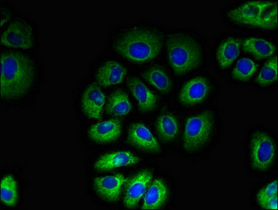TAS1R2 / T1R2 Antibody - Immunofluorescent analysis of A549 cells diluted at 1:100 and Alexa Fluor 488-congugated AffiniPure Goat Anti-Rabbit IgG(H+L)