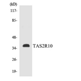 TAS2R10 / TRB2 Antibody - Western blot analysis of the lysates from HepG2 cells using TAS2R10 antibody.