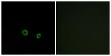 TAS2R10 / TRB2 Antibody - Immunofluorescence analysis of MCF7 cells, using TAS2R10 Antibody. The picture on the right is blocked with the synthesized peptide.