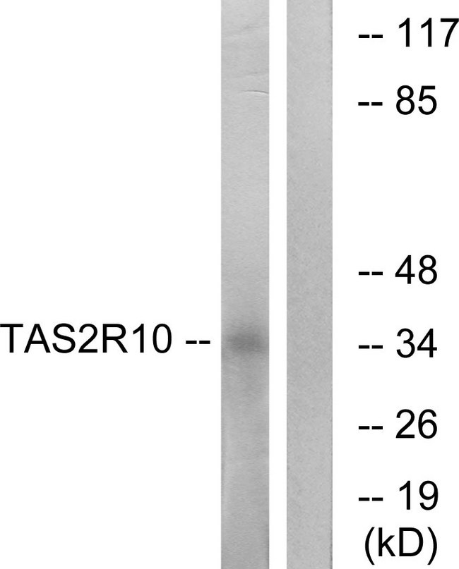 TAS2R10 / TRB2 Antibody - Western blot analysis of lysates from LOVO cells, using TAS2R10 Antibody. The lane on the right is blocked with the synthesized peptide.