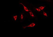 TAS2R10 / TRB2 Antibody - Staining LOVO cells by IF/ICC. The samples were fixed with PFA and permeabilized in 0.1% Triton X-100, then blocked in 10% serum for 45 min at 25°C. The primary antibody was diluted at 1:200 and incubated with the sample for 1 hour at 37°C. An Alexa Fluor 594 conjugated goat anti-rabbit IgG (H+L) Ab, diluted at 1/600, was used as the secondary antibody.