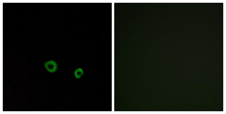 TAS2R10 / TRB2 Antibody - Peptide - + Immunofluorescence analysis of MCF-7 cells, using TAS2R10 antibody.