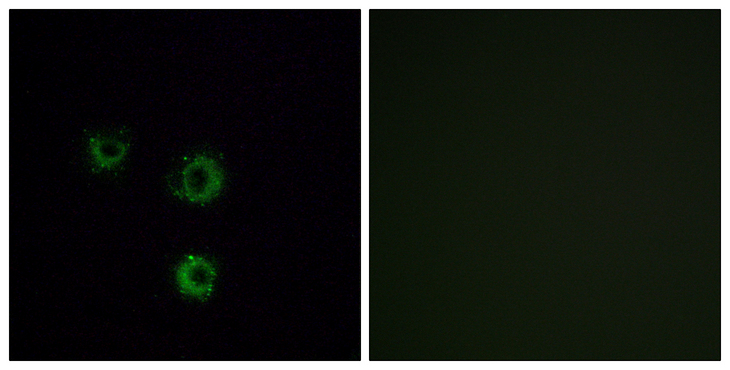 TAS2R14 / TRB1 Antibody - Immunofluorescence analysis of MCF7 cells, using TAS2R14 Antibody. The picture on the right is blocked with the synthesized peptide.