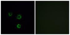 TAS2R14 / TRB1 Antibody - Immunofluorescence analysis of MCF7 cells, using TAS2R14 Antibody. The picture on the right is blocked with the synthesized peptide.