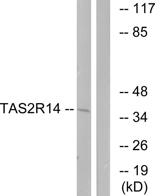 TAS2R14 / TRB1 Antibody - Western blot analysis of lysates from MCF-7 cells, using TAS2R14 Antibody. The lane on the right is blocked with the synthesized peptide.