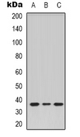 TAS2R14 / TRB1 Antibody - Western blot analysis of TRB1 expression in HeLa (A); COLO205 (B); L929 (C) whole cell lysates.